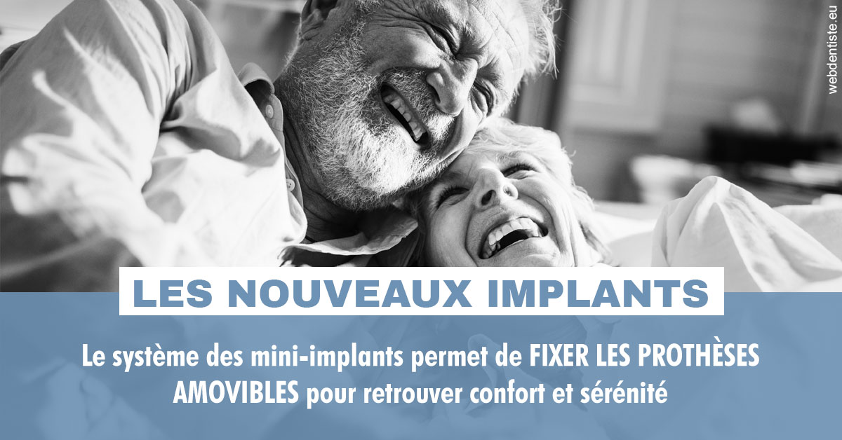 https://dr-crepin-julien.chirurgiens-dentistes.fr/Les nouveaux implants 2