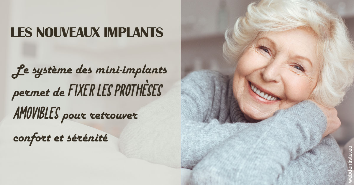 https://dr-crepin-julien.chirurgiens-dentistes.fr/Les nouveaux implants 1
