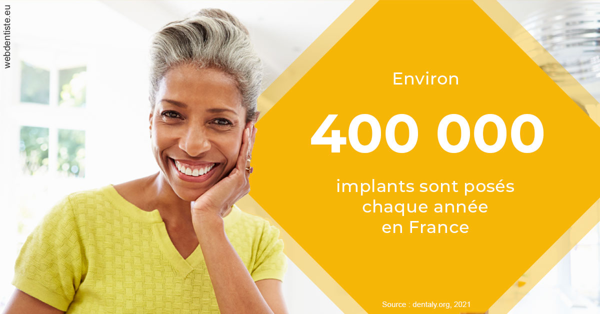 https://dr-crepin-julien.chirurgiens-dentistes.fr/Pose d'implants en France