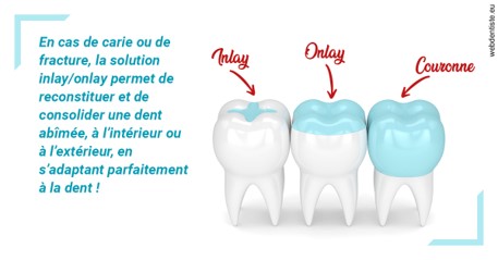 https://dr-crepin-julien.chirurgiens-dentistes.fr/L'INLAY ou l'ONLAY