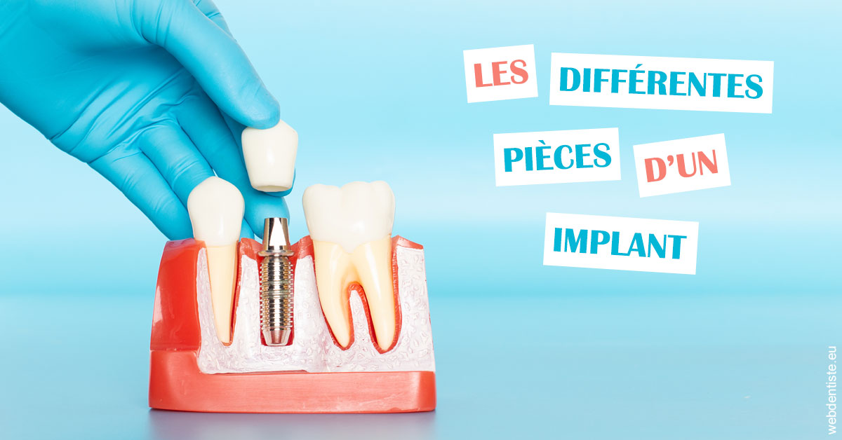 https://dr-crepin-julien.chirurgiens-dentistes.fr/Les différentes pièces d’un implant 2