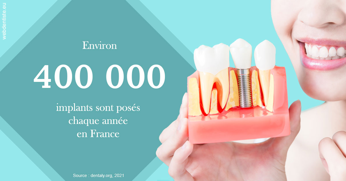 https://dr-crepin-julien.chirurgiens-dentistes.fr/Pose d'implants en France 2