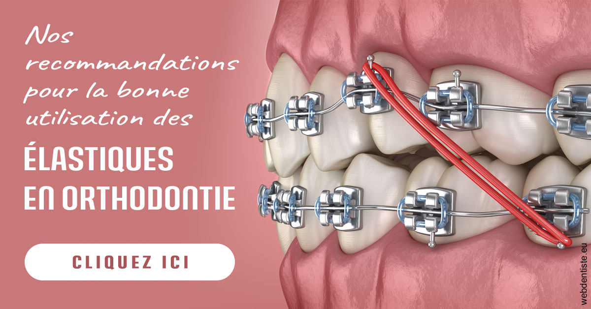https://dr-crepin-julien.chirurgiens-dentistes.fr/Elastiques orthodontie 2